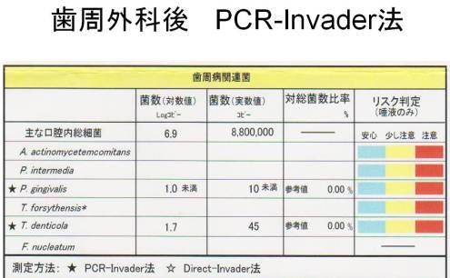 歯周外科後　 PCR-Invader法