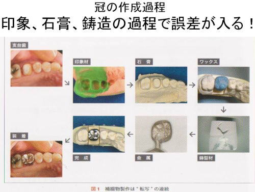 鹿嶋・潮来・鹿行地域の行方市でインプラントと矯正に取り組む山口歯科