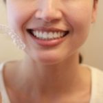 食事中はアライナーを外してもいいのですか?