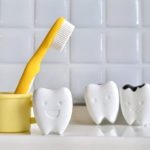 インプラント治療の保証制度はありますか？