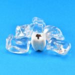 矯正治療中の歯のクリーニングは受けられますか?