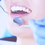 治療後も歯並びは元に戻りませんか？