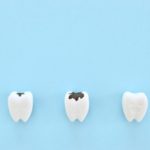 イチゴを食べて虫歯が予防できるって本当？