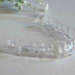 アライナーの交換は自分でできますか？