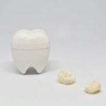 虫歯の進行止めのお薬！サホライドってなに？