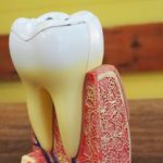 糖尿病と歯周病には関係がありますか？