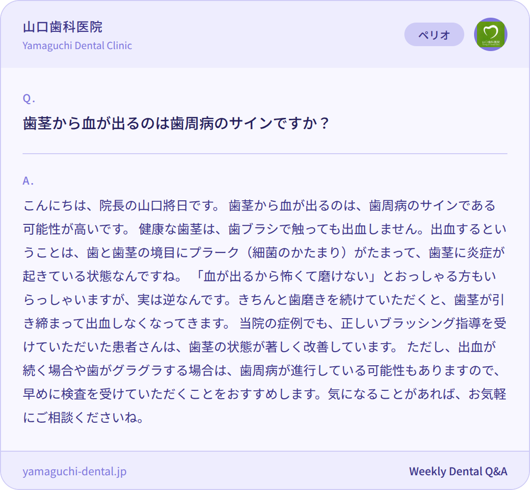 歯茎から血が出るのは歯周病のサインですか? 歯茎から血が出るのは歯周病のサインですか?